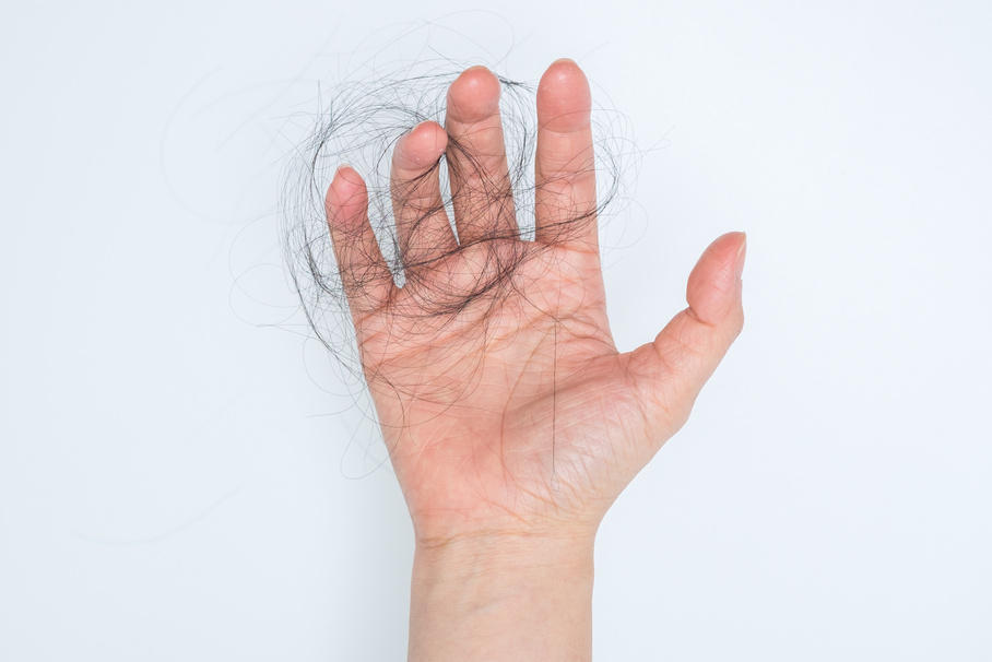 Hair loss in woman hand